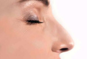 Chirurgie esthétique du nez ou rhinoplastie à Lyon - Dr Corniglion