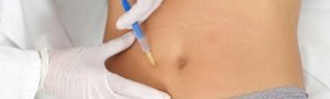 Lipomodelage lipofilling à Lyon - Dr Corniglion