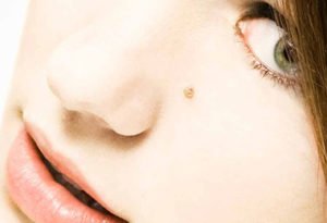 Chirurgie cutanée à Lyon - Dr Corniglion