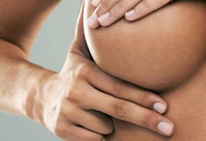 Chirurgie esthétique des seins à Lyon - Augmentation mammaire - Dr Corniglion