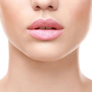 Injection d'acide hyaluronique pour les lèvres à Lyon - Dr Corniglion