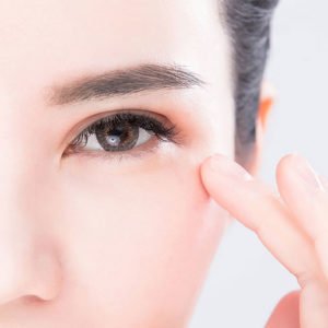 Chirurgie esthétique des paupières ou blépharoplastie à Lyon - Dr Corniglion