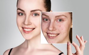 Préserver sa peau à Lyon - Dr Corniglion