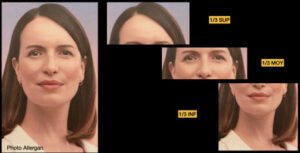 Evaluation selfie par le dr Corniglion à Lyon